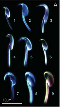 Hooked heads of several species of rodent's sperm